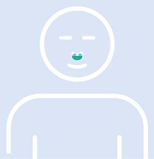 Dessin de l'emplacement d'un masque narinaire sur le visage d'un patient traité pour l'apnée du sommeil