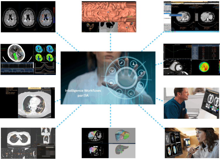 L&rsquo;intelligence artificielle workflow