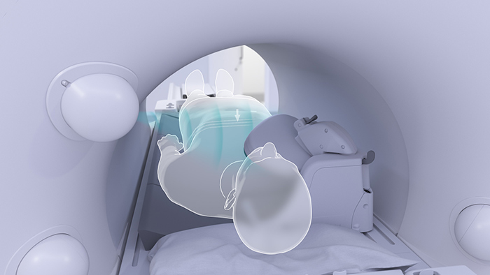 Photo d&rsquo;un syst&egrave;me IRM et d&rsquo;un patient avec d&eacute;tection du patient sans contact pour pr&eacute;parer l&rsquo;acquisition