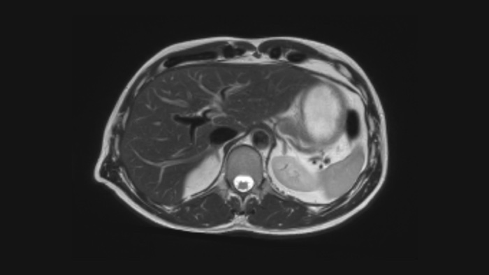Image clinique du cerveau