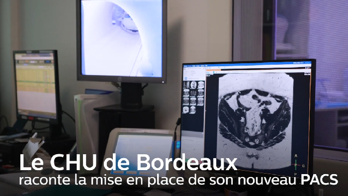 T&eacute;moignage CHU Bordeaux - Vue PACS