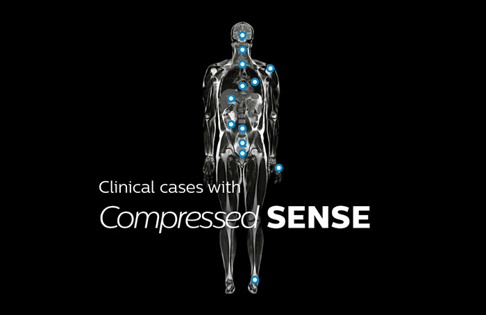 Ordinateur, tablette et t&eacute;l&eacute;phone avec cartographie anatomique IRM affichant des cas cliniques de presque toutes les anatomies