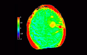 Cerveau image