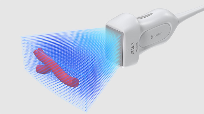 r&eacute;solution 3D 4D haute qualit&eacute;
